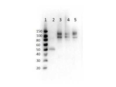 Western Blot: ODF2 [p Ser796] Antibody [NB110-85525] - Western Blot of ODF2 [p Ser796] antibody. Lane 1: MW.Lane 2: Human Semen Lysate.Lane 3: MCF7 WCL. Lane 4: Molt 4 WCL. Lane 5: HeLa WCL. Load: 10ug per lane. Blocking:. Primary Antibody: Anti-ODF2 pS796 at 1ug/mL overnight at 2-8C.Secondary Antibody: Goat anti-Rabbit HRP 1:40,000 diluted in for 30 minutes at RT.Expect: 93kDa.